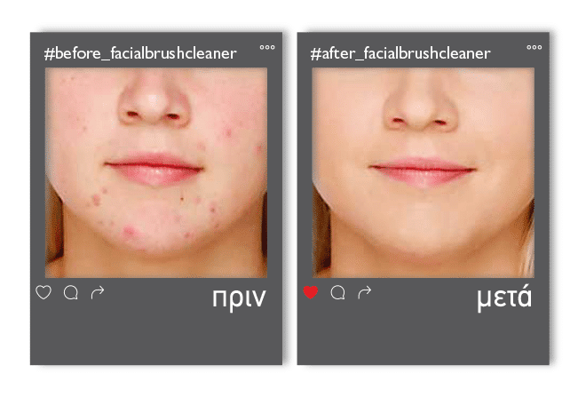 Facialbrushcleaner_enthesi_1